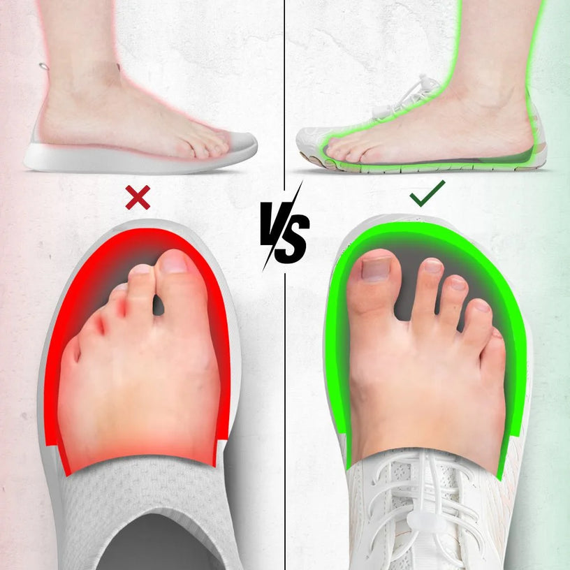 3. Wide Toe-Box For Wide Feet & Bunion